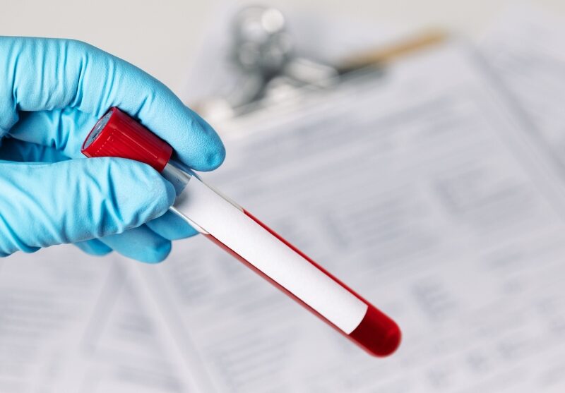 Etichette speciali due casi davvero eccezionali per il settore medicale